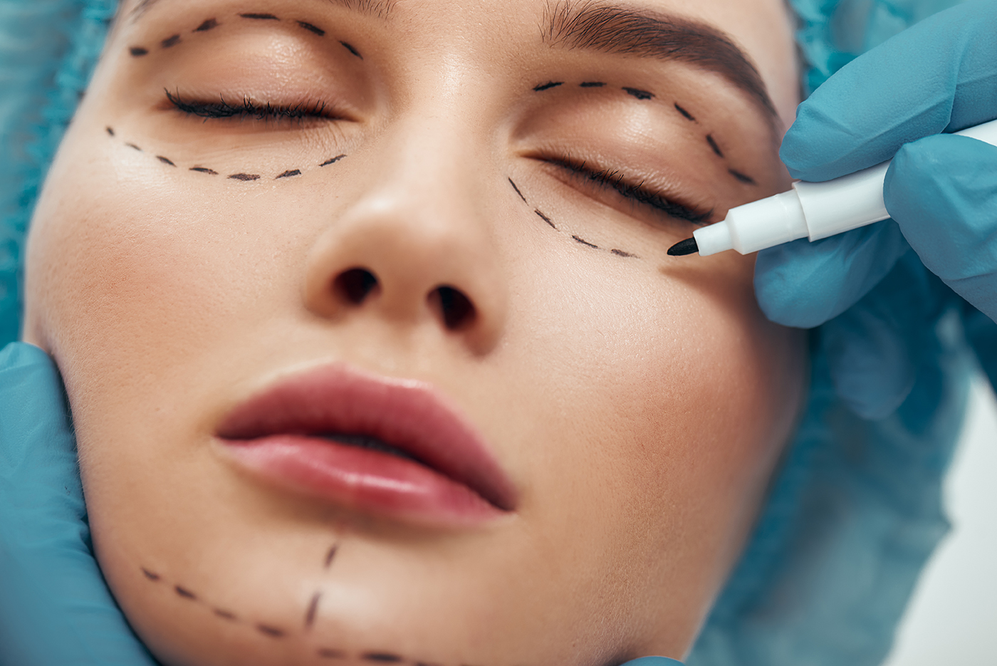 Understanding The Basics Of Oculoplastic Surgery: A Guide For Patients