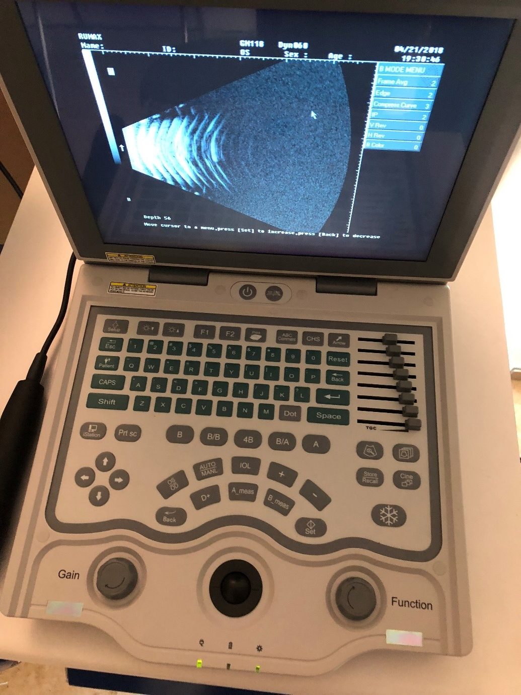 Fundus Photography For Retinal Examination