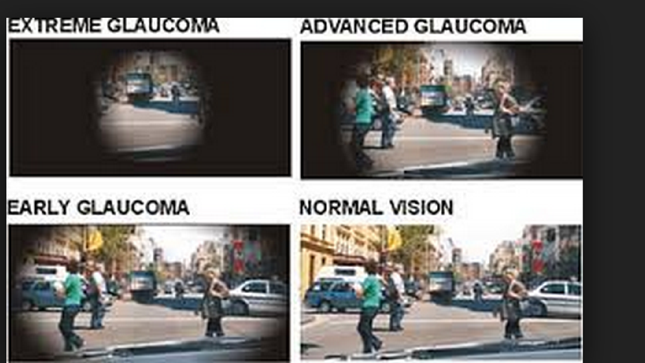 how a person with glaucoma sees the world
